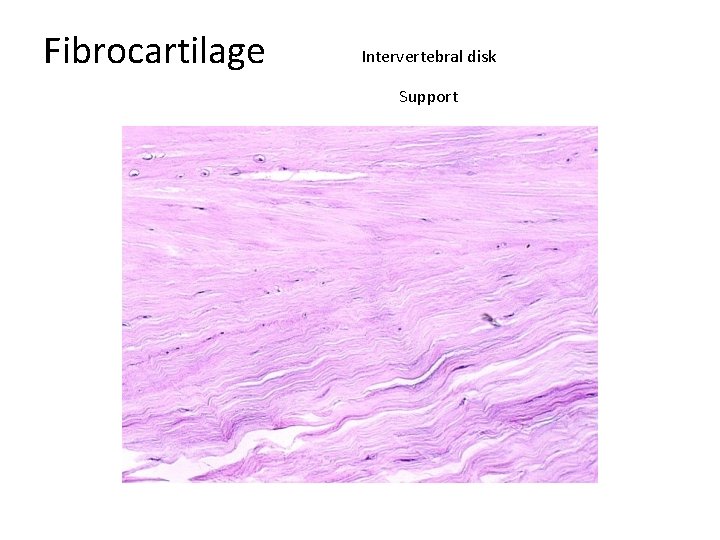 Fibrocartilage Intervertebral disk Support 