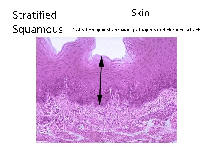 Stratified Squamous Skin Protection against abrasion, pathogens and chemical attack 