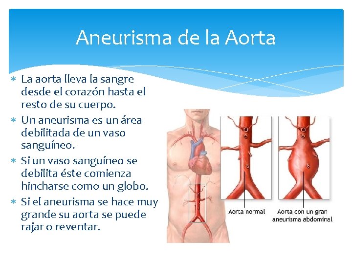 Aneurisma de la Aorta La aorta lleva la sangre desde el corazón hasta el