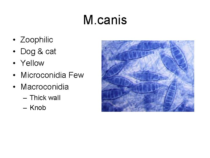 M. canis • • • Zoophilic Dog & cat Yellow Microconidia Few Macroconidia –