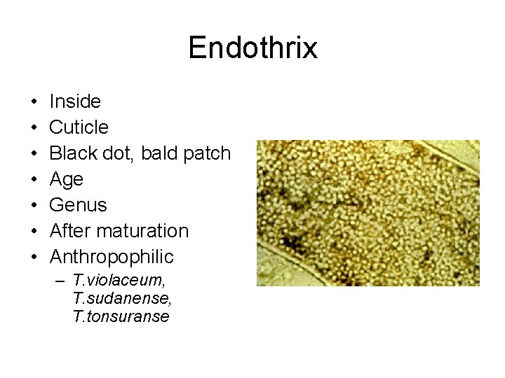 Endothrix • • Inside Cuticle Black dot, bald patch Age Genus After maturation Anthropophilic