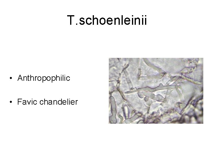 T. schoenleinii • Anthropophilic • Favic chandelier 