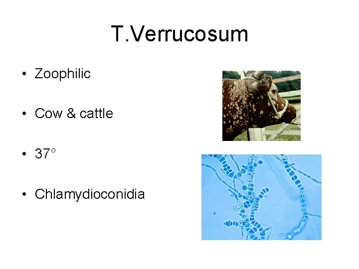 T. Verrucosum • Zoophilic • Cow & cattle • 37° • Chlamydioconidia 