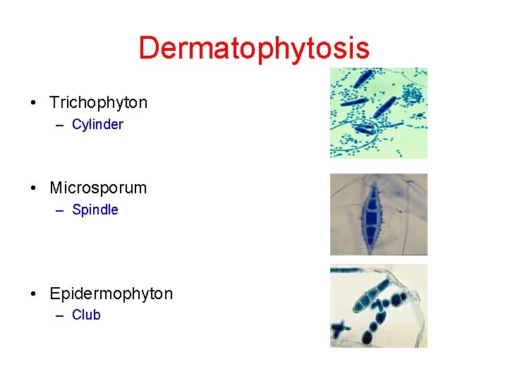 Dermatophytosis • Trichophyton – Cylinder • Microsporum – Spindle • Epidermophyton – Club 