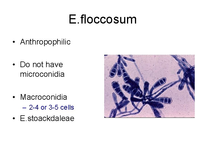 E. floccosum • Anthropophilic • Do not have microconidia • Macroconidia – 2 -4