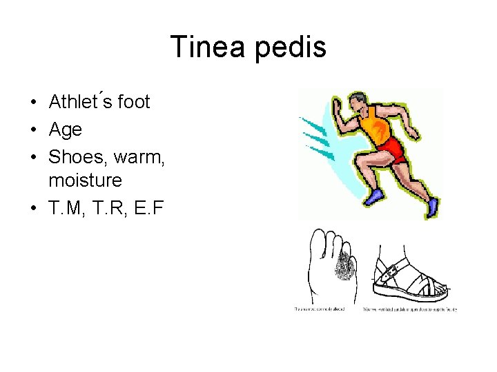 Tinea pedis • Athlet s foot • Age • Shoes, warm, moisture • T.