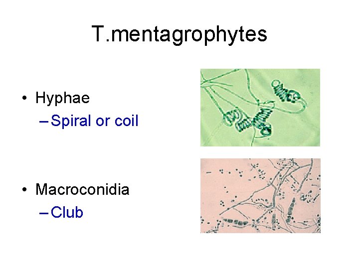T. mentagrophytes • Hyphae – Spiral or coil • Macroconidia – Club 
