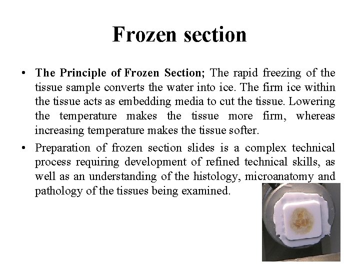 Frozen section • The Principle of Frozen Section; The rapid freezing of the tissue