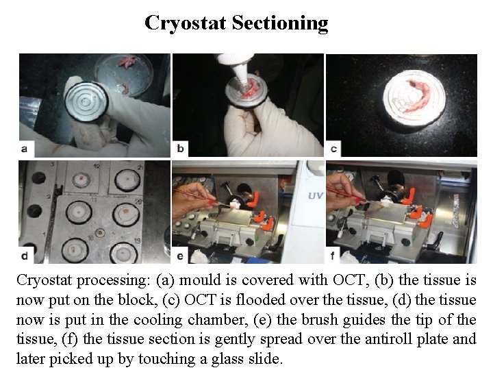 Cryostat Sectioning Cryostat processing: (a) mould is covered with OCT, (b) the tissue is
