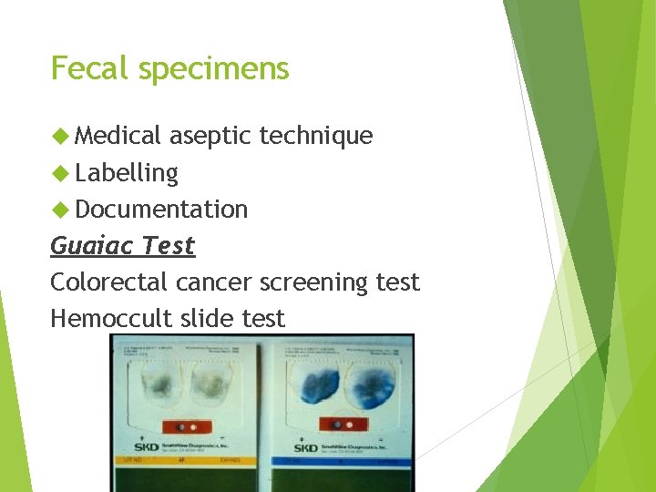 Fecal specimens Medical aseptic technique Labelling Documentation Guaiac Test Colorectal cancer screening test Hemoccult