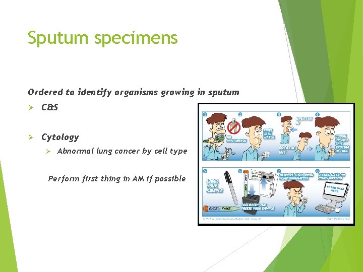 Sputum specimens Ordered to identify organisms growing in sputum Ø C&S Ø Cytology Ø