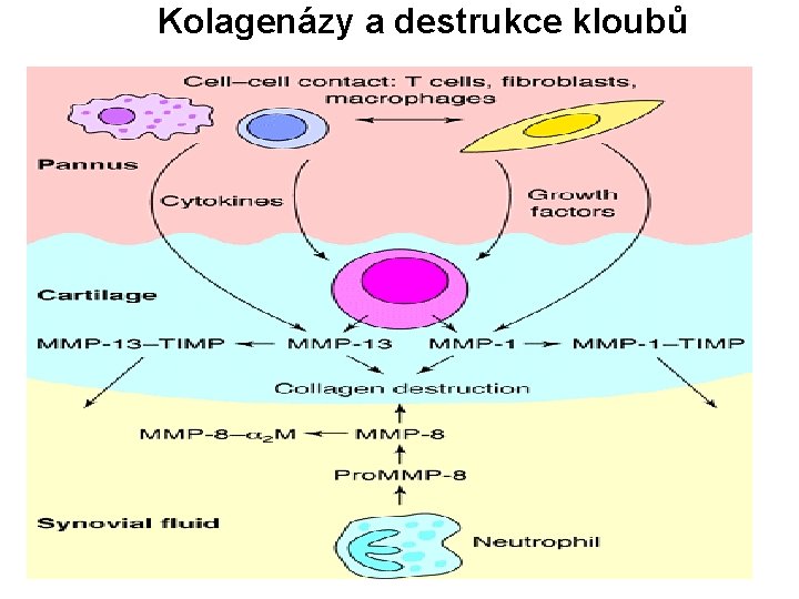 Kolagenázy a destrukce kloubů 