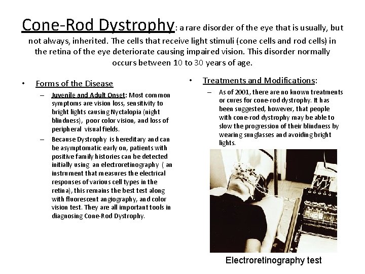 ConeRod Dystrophy a rare disorder of the eye