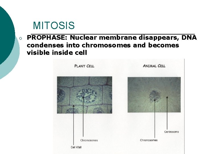 MITOSIS o PROPHASE: Nuclear membrane disappears, DNA condenses into chromosomes and becomes visible inside