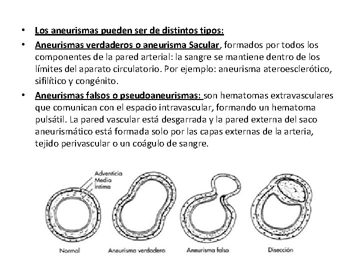  • Los aneurismas pueden ser de distintos tipos: • Aneurismas verdaderos o aneurisma