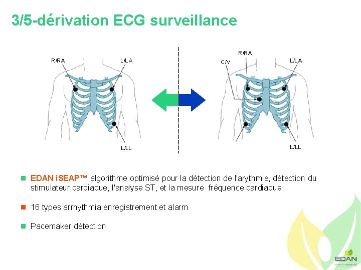 3/5 -dérivation ECG surveillance R/RA L/LA L/LL C/V L/LA L/LL n EDAN i. SEAP™