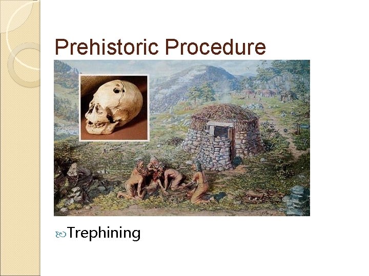 Prehistoric Procedure Trephining 