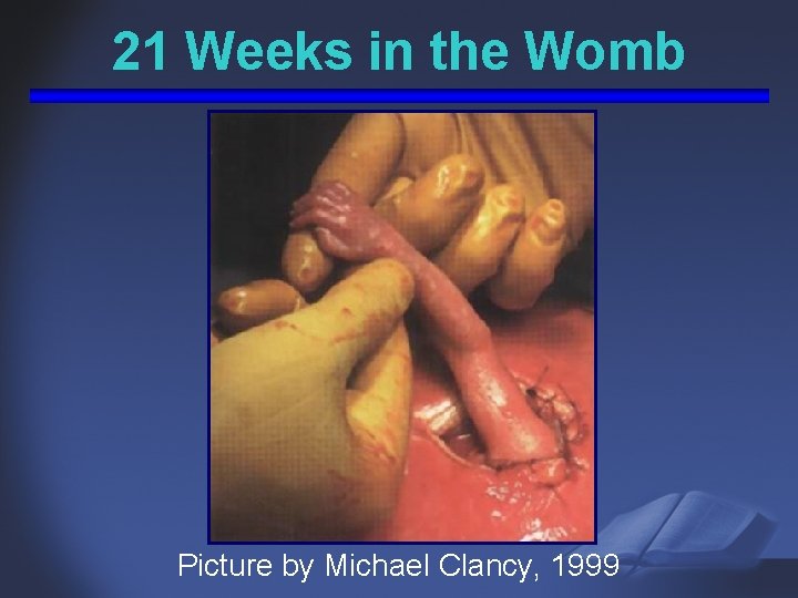 21 Weeks in the Womb Picture by Michael Clancy, 1999 