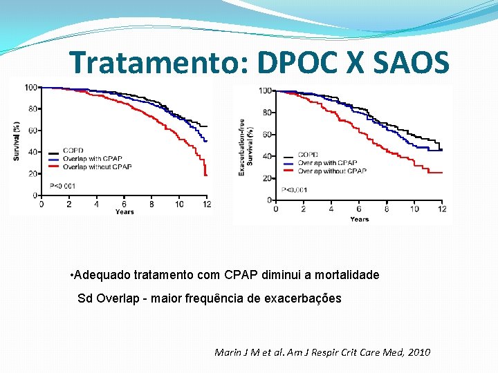 Tratamento: DPOC X SAOS • Adequado tratamento com CPAP diminui a mortalidade Sd Overlap