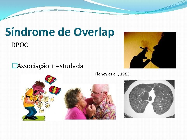 Síndrome de Overlap DPOC �Associação + estudada Fleney et al. , 1985 