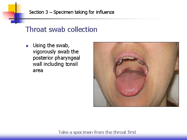 Section 3 – Specimen taking for influenza Throat swab collection n Using the swab,