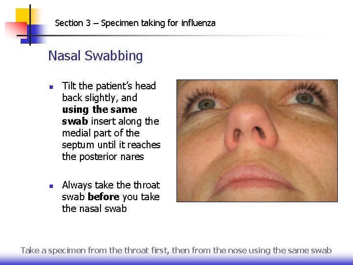 Section 3 – Specimen taking for influenza Nasal Swabbing n n Tilt the patient’s