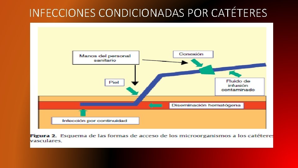 INFECCIONES CONDICIONADAS POR CATÉTERES 