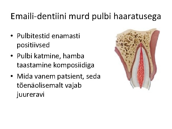 Emaili-dentiini murd pulbi haaratusega • Pulbitestid enamasti positiivsed • Pulbi katmine, hamba taastamine komposiidiga