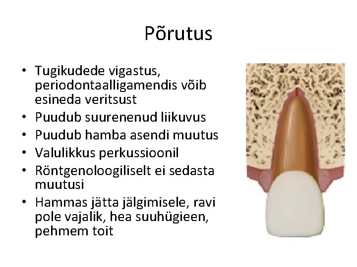 Põrutus • Tugikudede vigastus, periodontaalligamendis võib esineda veritsust • Puudub suurenenud liikuvus • Puudub