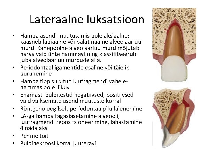 Lateraalne luksatsioon • Hamba asendi muutus, mis pole aksiaalne; kaasneb labiaalne või palatinaalne alveolaarluu