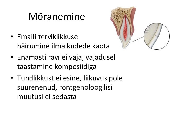 Mõranemine • Emaili terviklikkuse häirumine ilma kudede kaota • Enamasti ravi ei vaja, vajadusel