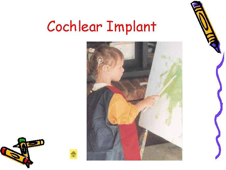 Cochlear Implant Cochlear Implant
