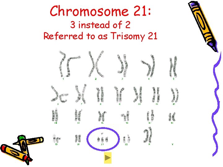 Chromosome 21: 3 instead of 2 Referred to as Trisomy 21 Chromosome 21: 3 instead of 2 Referred to as Trisomy 21
