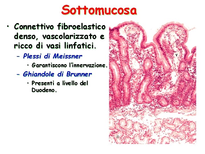 Sottomucosa • Connettivo fibroelastico denso, vascolarizzato e ricco di vasi linfatici. – Plessi di