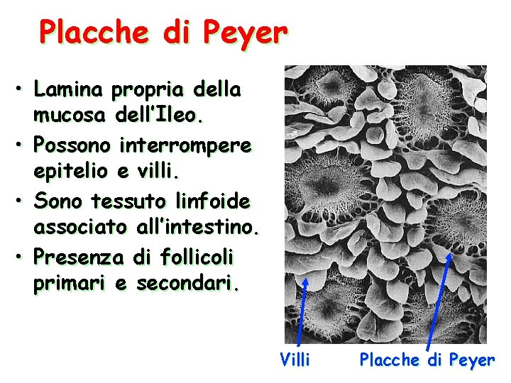 Placche di Peyer • Lamina propria della mucosa dell’Ileo. • Possono interrompere epitelio e