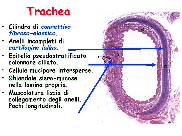 Trachea • Cilindro di connettivo fibroso-elastico. • Anelli incompleti di cartilagine ialina. • Epitelio