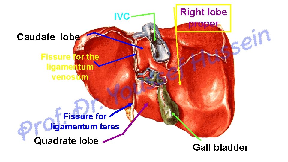 IVC Right lobe proper Caudate lobe Fissure for the ligamentum venosum Fissure for ligamentum