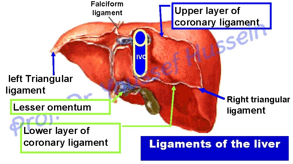 Falciform ligament Upper layer of coronary ligament IVC left Triangular ligament Lesser omentum Lower