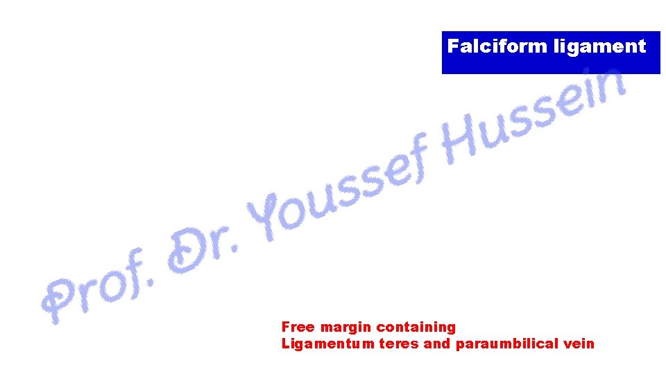 Falciform ligament Free margin containing Ligamentum teres and paraumbilical vein 