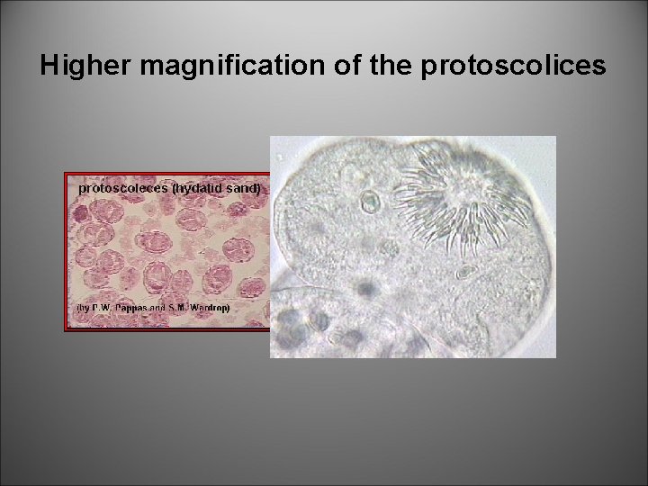 Higher magnification of the protoscolices 