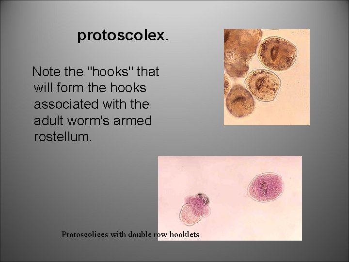 protoscolex. Note the "hooks" that will form the hooks associated with the adult worm's