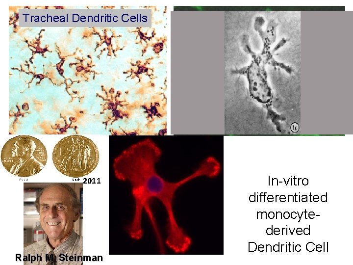 Tracheal Dendritic Cells 2011 Ralph M Steinman Langerhan’s cells In-vitro differentiated monocytederived Dendritic Cell