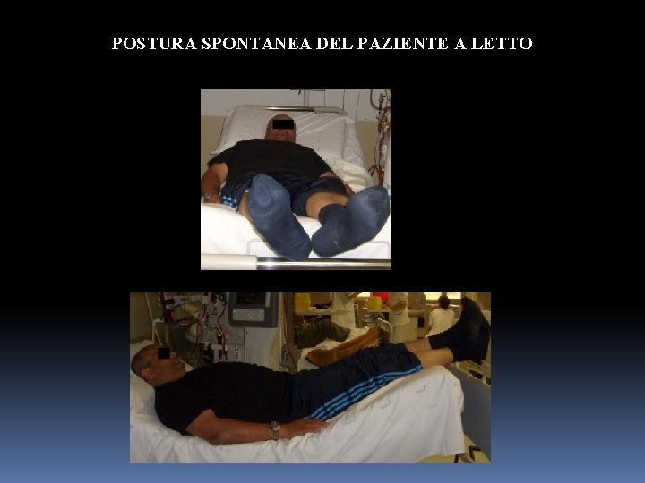 POSTURA SPONTANEA DEL PAZIENTE A LETTO 