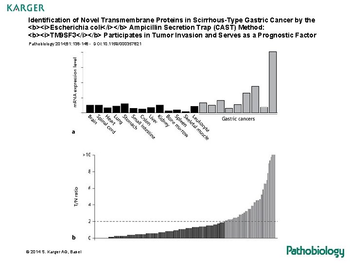 Identification of Novel Transmembrane Proteins in Scirrhous-Type Gastric Cancer by the <b><i>Escherichia coli</i></b> Ampicillin