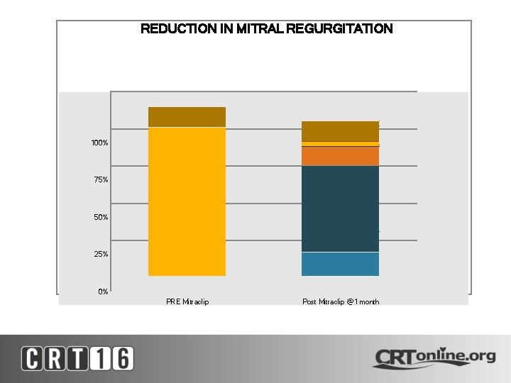 REDUCTION IN MITRAL REGURGITATION 100% 75% 50% 25% 0% PRE Mitraclip Post Mitraclip @1