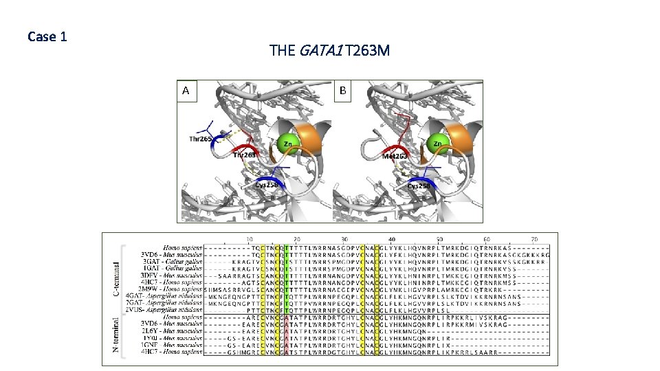 Case 1 THE GATA 1 T 263 M A B 