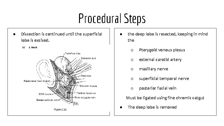 Procedural Steps ● Dissection is continued until the superficial lobe is excised. ● the