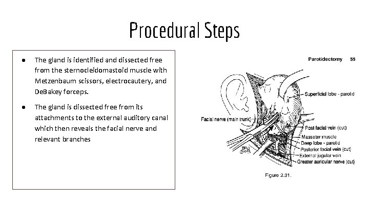 Procedural Steps ● The gland is identified and dissected free from the sternocleidomastoid muscle