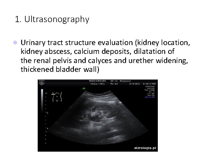 1. Ultrasonography Urinary tract structure evaluation (kidney location, kidney abscess, calcium deposits, dilatation of