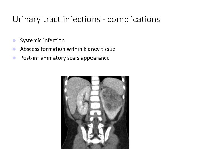 Urinary tract infections - complications Systemic infection Abscess formation within kidney tissue Post-inflammatory scars
